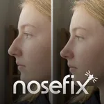 Nose Editor Fixer Reshape AI icon