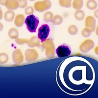 Chronic Lymphocytic Leukemia icon