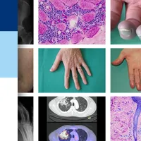 Rheumatologie visuell icon