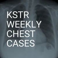 KSTR Weekly Chest Cases icon