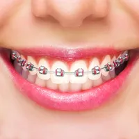 Fake Braces Face Photo Editor icon