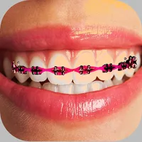 Braces Photo Editor - Stickers icon