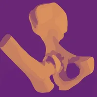 PapadimitriouAbductionSplint icon