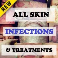 Skin Infections and Treatments icon