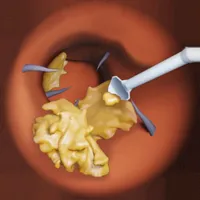 Endoscope cleaning ear icon