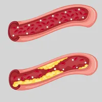 Peripheral Vascular Disease icon