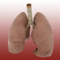 Non-Small-Cell Lung Cancer icon