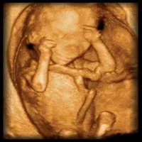 BCM OB Ultrasound icon