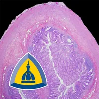 Appendiceal Pathology icon