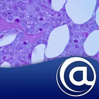 Multiple Myeloma (MM) icon