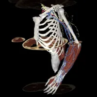 3Dissect Upper Limb icon