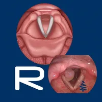 Vocal Pathology: Reflux icon