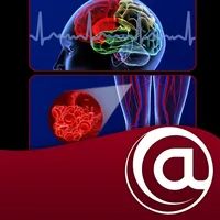 Stroke Prevention in AFib icon