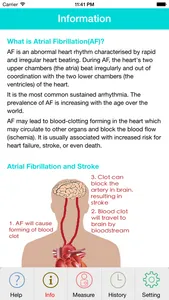 Photo AFib Detector (Lite) screenshot 2