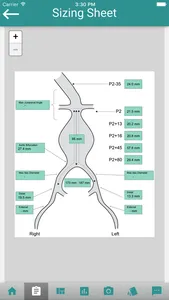 EndoSizeMe screenshot 2