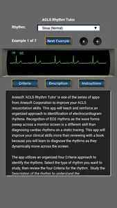 ACLS Rhythm Tutor screenshot 0