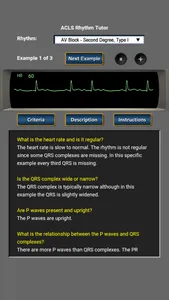 ACLS Rhythm Tutor screenshot 1