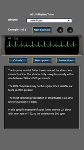 ACLS Rhythm Tutor screenshot 2