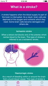 FAST Test screenshot 1