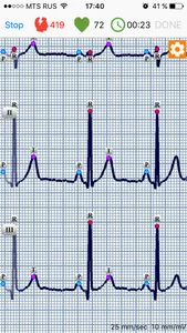 ECG Dongle screenshot 1