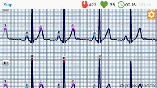 ECG Dongle screenshot 2