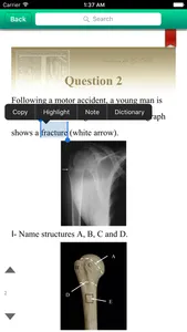 Anatomy For GSSE  for iPhone screenshot 1