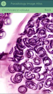 Parasitology Image Atlas screenshot 1