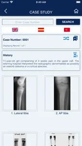 MSK RADIOLOGY 4 U screenshot 3