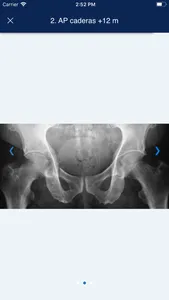 MSK RADIOLOGY 4 U screenshot 4