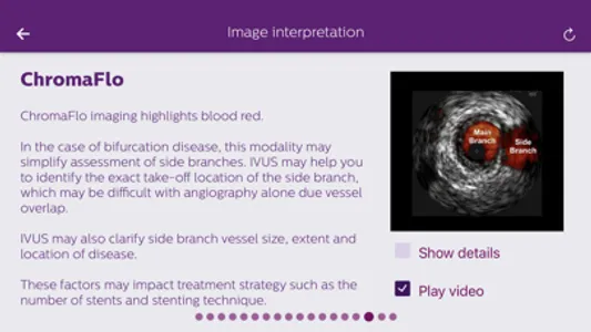 Philips Coronary IVUS Tutor screenshot 1