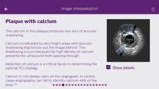 Philips Coronary IVUS Tutor screenshot 2