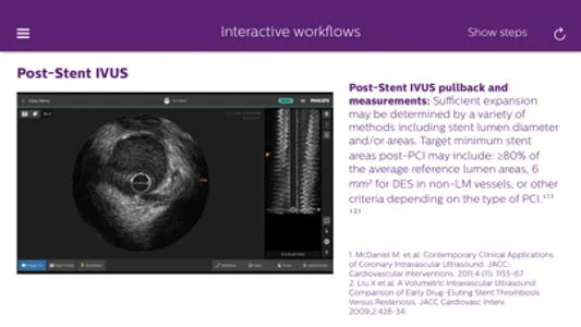 Philips Coronary IVUS Tutor screenshot 6