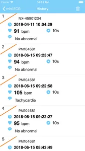 mini ECG screenshot 2