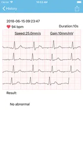 mini ECG screenshot 3