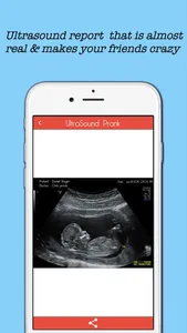 Baby Ultrasound spoof screenshot 1