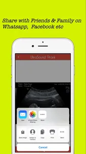 Baby Ultrasound spoof screenshot 2