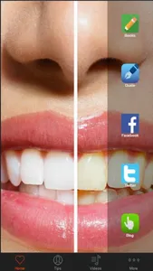 Teeth Whitening Tips - Learn How to Whiten Teeth screenshot 0