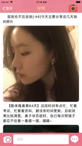 北京整形美容圈-微整形美容交流分享 screenshot 1