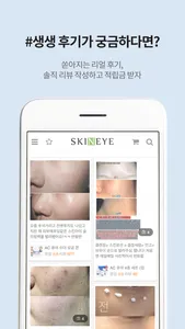 스킨아이 - skineye screenshot 3