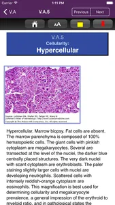 Lichtman's Atlas of Hematology screenshot 3