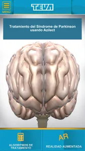TEVA Neuro screenshot 1