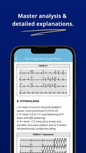 ECG EKG Interpretation Mastery screenshot 2