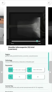 Navi Radiography Lite screenshot 3