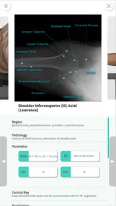 Navi Radiography Lite screenshot 5