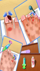 Nail doctor : Kids games toe surgery doctor games screenshot 1