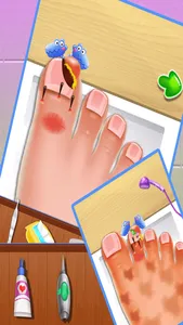 Nail doctor : Kids games toe surgery doctor games screenshot 2