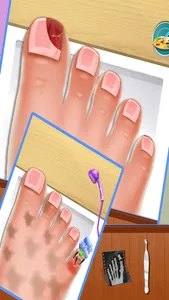 Nail doctor : Kids games toe surgery doctor games screenshot 4