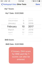 BoneGauge screenshot 1