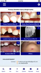 Injured Tooth screenshot 1