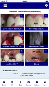 Injured Tooth screenshot 2